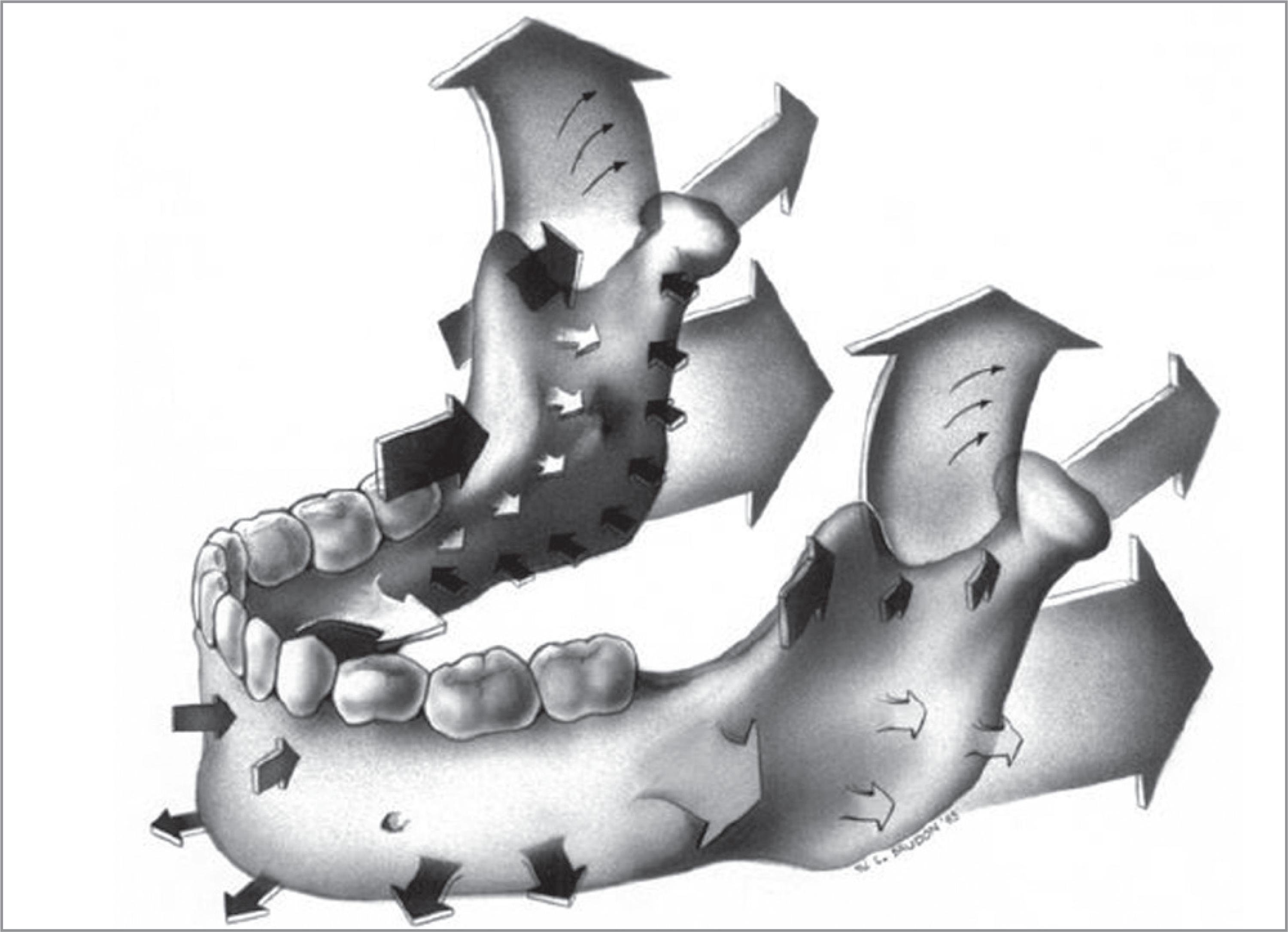 Schematic representation of the remodeling of the jaw